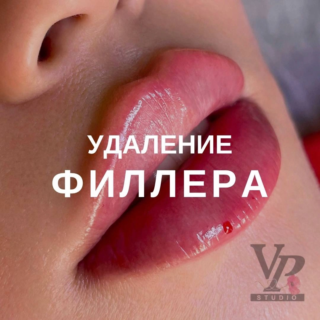 VP Studio - фото 3